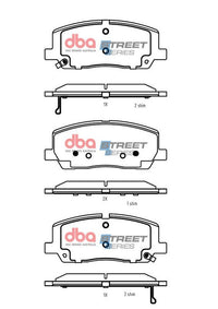 Brake Pads Street Series | Front Axle - DB2756SS
